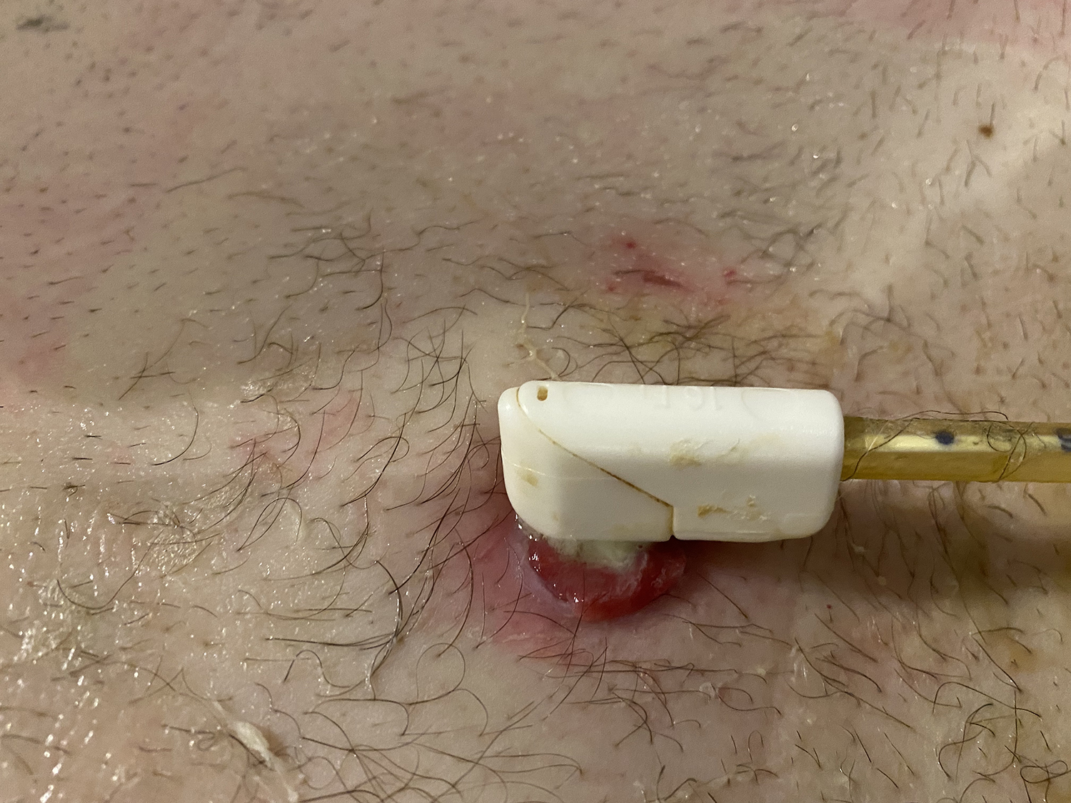 My PEG Site